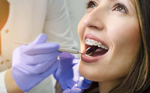 DIY Orthodontic Treatment