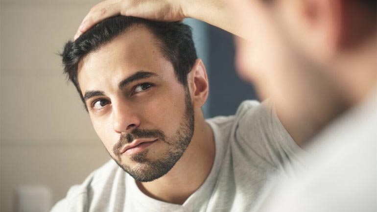 Signs-Hair-Thinning