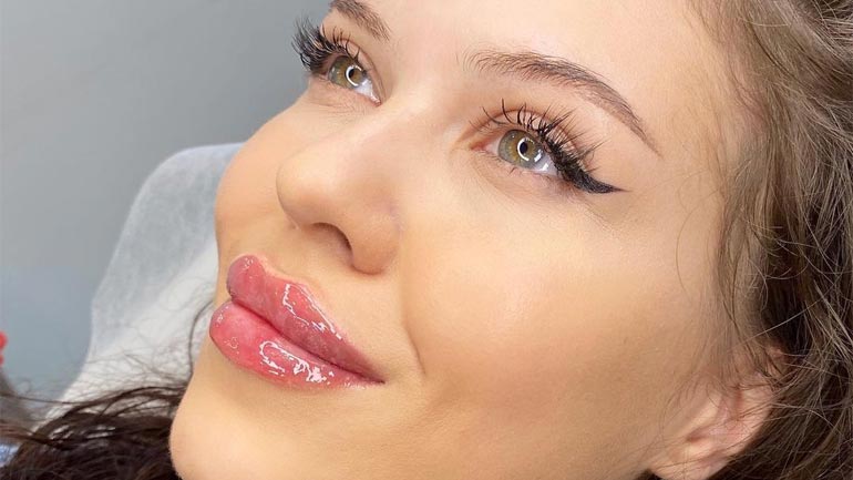 Lips-Fillers-Things-Should-Know