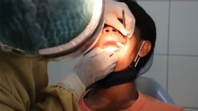 Ignore Teeth Problems Visit Dentist