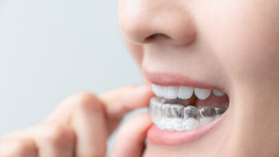 Teeth Invisalign Effective