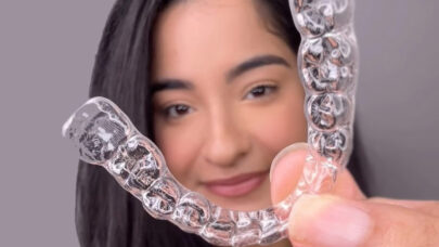 Clear-Aligners-From-Style-to-cost