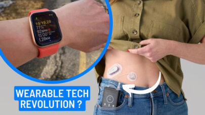 Wearable Tech Revolution Health Tracking