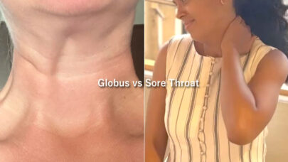 Globus-vs-Sore-Throat-Difference