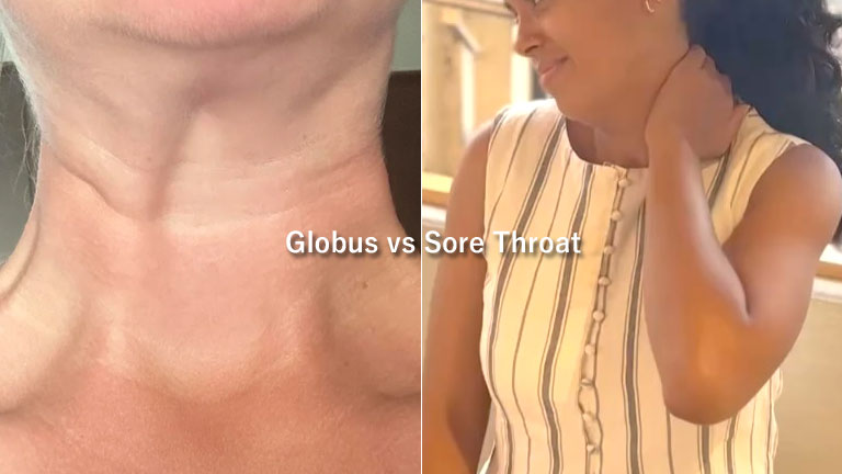 Globus-vs-Sore-Throat-Difference