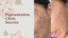Pigmentation Clinic Secrets