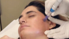 acne Clinics Worth Investment