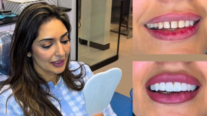 Cosmetic Dentistry Natural Extension