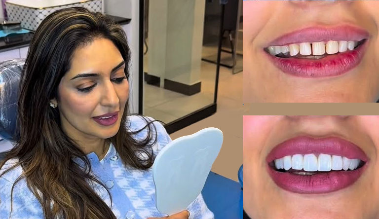 Cosmetic Dentistry Natural Extension