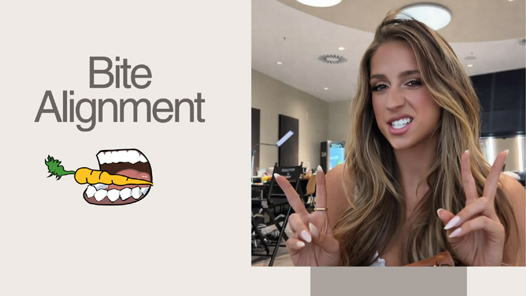 Bite Alignment Matters