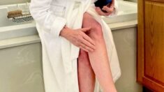 Crepey Skin Cause Home Remedies