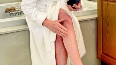 Crepey Skin Cause Home Remedies