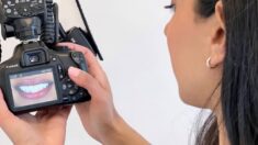 Dentist Looking Photo Cosmetic Results