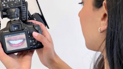 Dentist Looking Photo Cosmetic Results