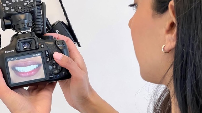 Dentist Looking Photo Cosmetic Results