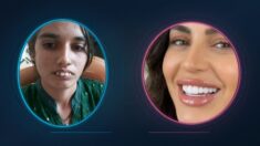 Gaps Misalignment and straight Teeth