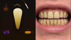 Causes of Yellow Teeth