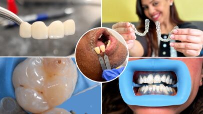 Cosmetic General Dentistry