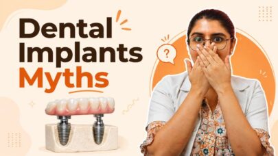 Myths About Dental Implants