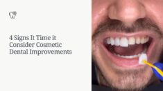 Signs Consider Cosmetic Dental Improvements